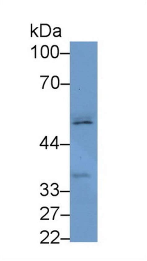 Fscn Polyclonal Antibody Invitrogen L Unconjugated Products