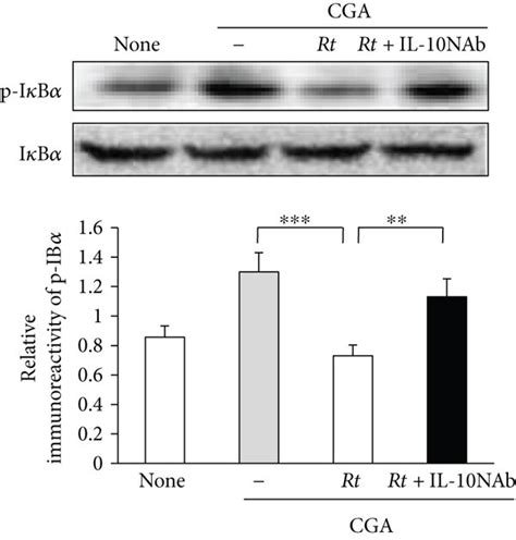 Effects Of Rt On The Nf κb Activation Pathways In Cga Stimulated