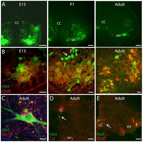 Hb9 Egfp Positive Neurons In Spinal Cord Sections Of Embryonic Early