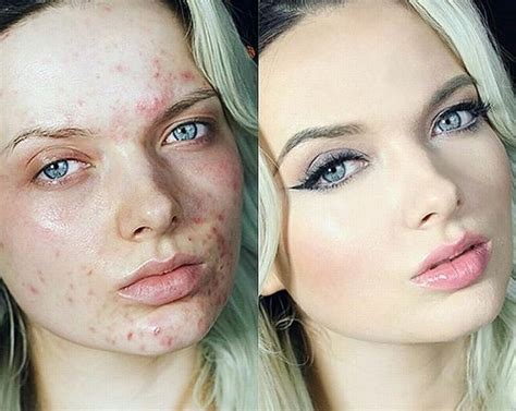 ЛЕГЕНДАРНЫЙ ТОНАЛЬНЫЙ КРЕМ DERMACOL С ВЫСОКИМ МАСКИРУЮЩИМ ЭФФЕКТОМ ...