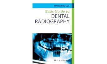 Basic Guide to Dental Radiography : Reynolds, Tim: Amazon.co.za: Books