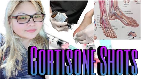 Cortisone Shots On My Feet Plantar Fasciitis Neuromas Injections