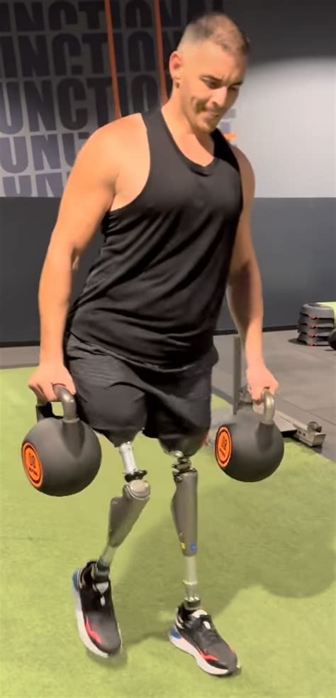 Gay Amputee Fetichism And Others