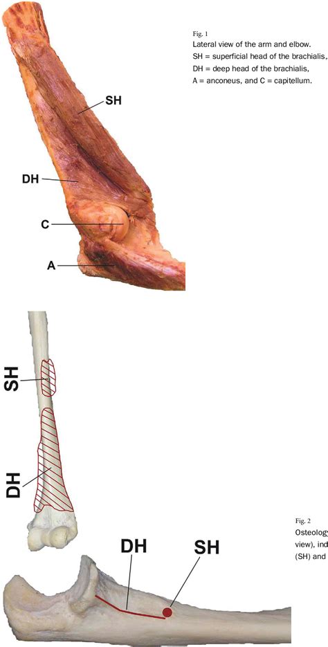 Brachialis Cadaver