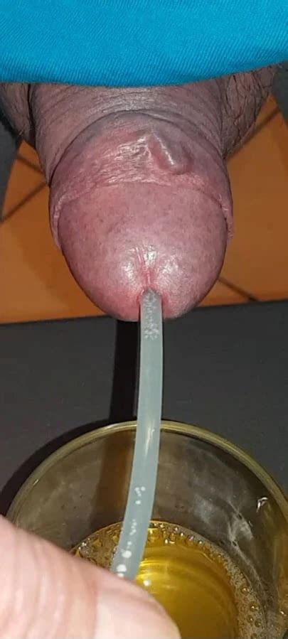 My Piss With Catheter 50 Nude Pics XHamster