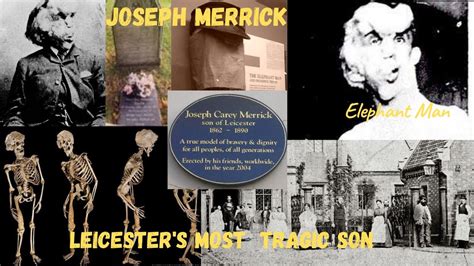 Joseph Merrick Elephant Man” Leicesters Most Tragic Son Youtube