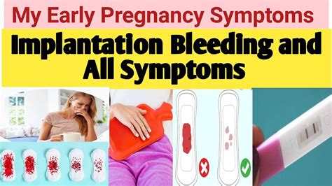 Top Implantation Bleeding Images Amazing Collection Implantation