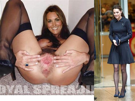 KATE Dressed And Undressed Porn Pictures XXX Photos Sex Images 1583405 PICTOA