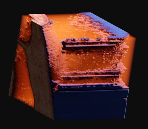 visualizing  visible human dataset  voraldo