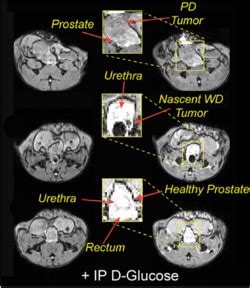 Figure From Advances In Gadolinium Based Mri Contrast Agent Designs