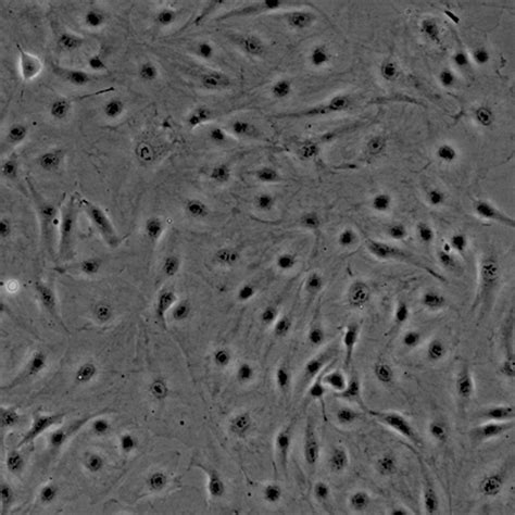 Human Pulmonary Artery Endothelial Cells Innoprot Cell Systems