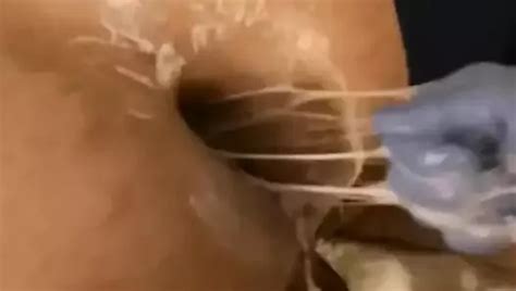 Fistlovergr Ruined Hole Gay Porn Xhamster