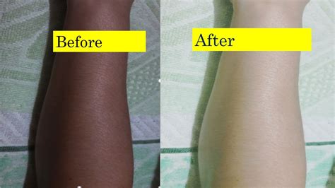 How To Lighten Face And Body Skin Color In 5 Days Magical Skin Whitener