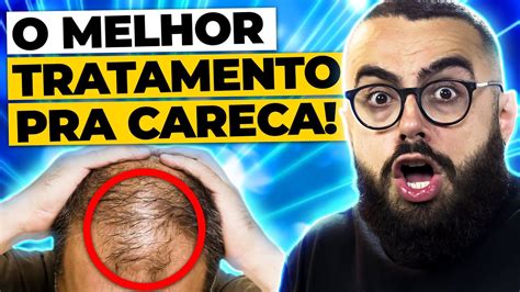 Qual Melhor Tratamento Para Queda De Cabelo Masculino Youtube