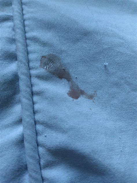 My cat has leaked liquid from her bum twice now. : r/CATHELP