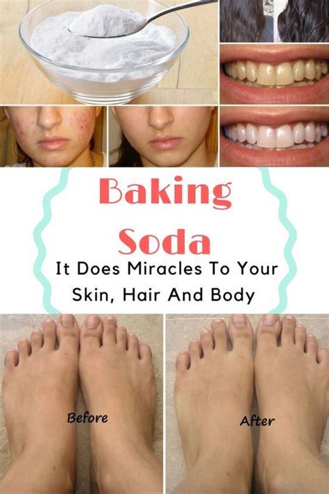 The Powers Of Baking Soda It Does Miracles To Your Skin Hair And