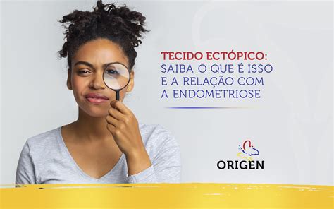 Tecido Ectópico Saiba O Que é Isso E A Relação Com A Endometriose