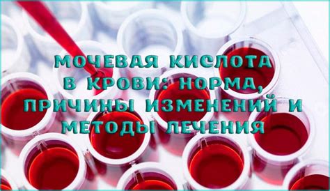 Мочевая кислота в крови: норма, причины изменений и методы лечений
