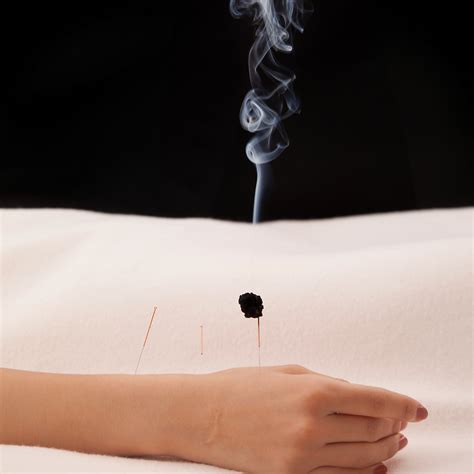 Moxibustion Harnessing The Power Of Heat For Healing