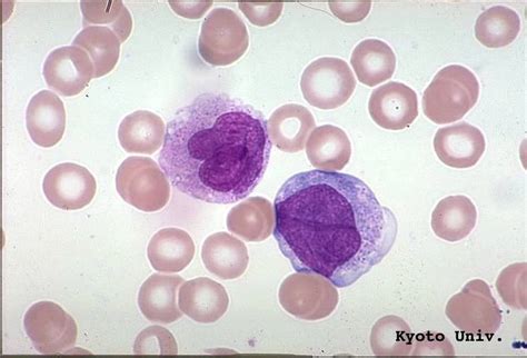 Monocyte Junglekeyfr Image