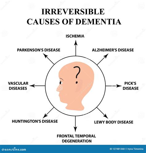 Irreversible Causes Of Senile Dementia Alzheimer`s Disease