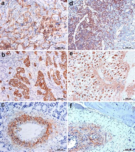 Immunohistochemical Staining Of Human Tissue Samples Processed