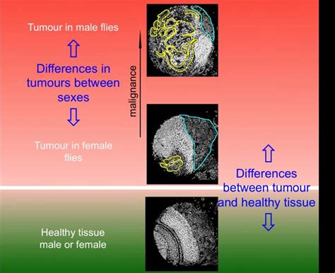 Investigating The Molecular Basis Of Sex Related Differences In Cancer Cell And Molecular Biology