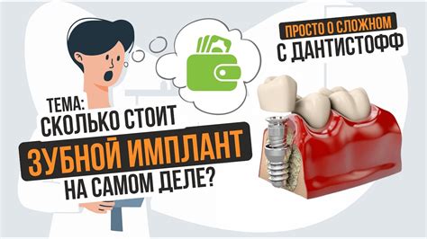 Сколько стоит зубной имплант? → Просто о сложном с Дантистофф # ...