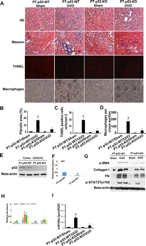 P53 Deletion From Proximal Tubules Attenuated Renal Fibrosis Apoptosis