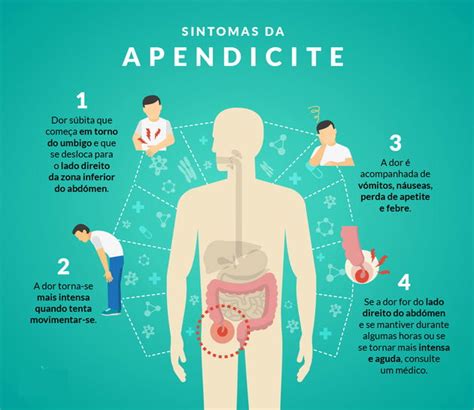 Aonde Fica O Apendice - Localizacao Do Apendice Humano