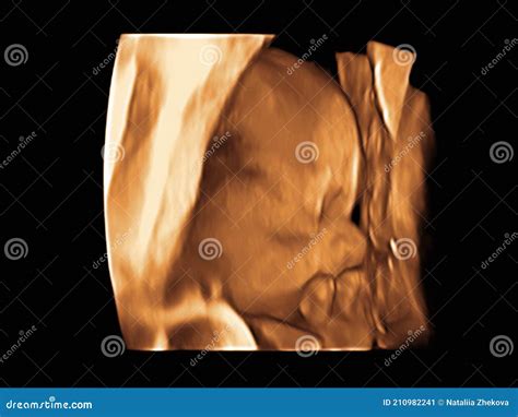 Image Ultrasound 3D 4D Of Baby In Mother Womb Stock Image Image Of