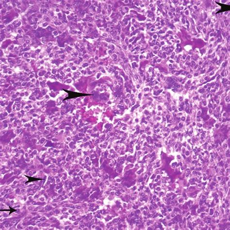 Photomicrograph Demonstrating Multinucleated Giant Cells Large