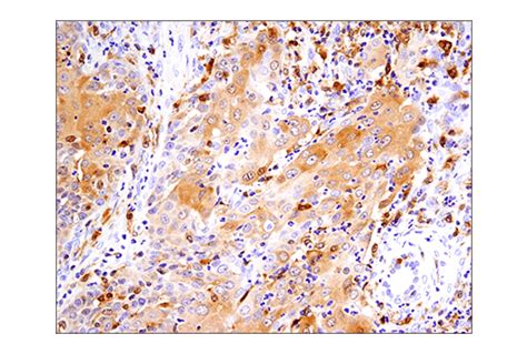IRF-5 (E7F9W) Rabbit mAb | Cell Signaling Technology