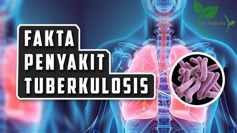 Fakta Dan Cara Penangulangan Penyakit Tuberkulosis Paru Youtube Sexiz Pix