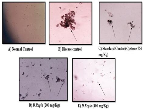 Figure 1 From Evaluation Of Anti Urolithiatic Activity Of Ethanolic