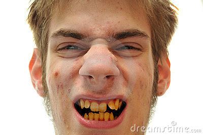 mundo loko os dentes mais podres