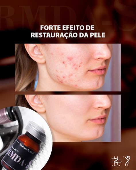 Pin Auf Rmda S Inova O Para Est Tica E Skincare