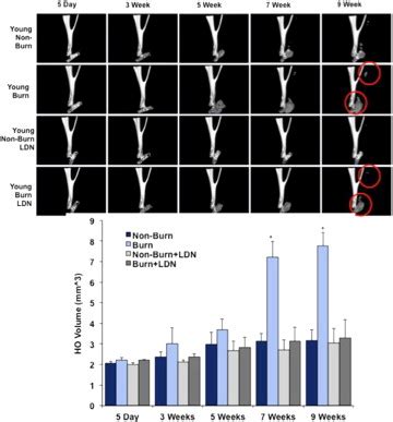 Use Of Constitutively Active Alk 3 Knockout Mice Do Demonstrate The