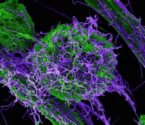 Nih Awards 12 Million For Antiviral Therapeutic Development National