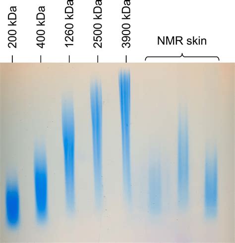 Agarose Gel Electrophoresis Of Ha In Nmr Skin Samples Nmr Skin Samples