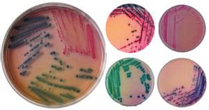 chromagar composition principle preparation results