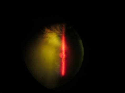 Optic Nerve The Remarkable Eye Harmony Eyecare Center Dr David