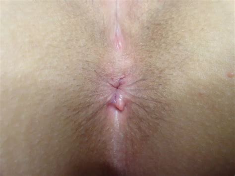 Raw Asshole Nude Pics XHamster