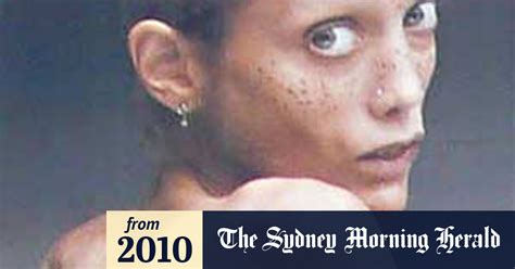 Anorexic Nude Model Isabelle Caro Dead