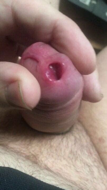 Raisin Qui Sort Du Cul French Gay Anal Amateur Porn XHamster