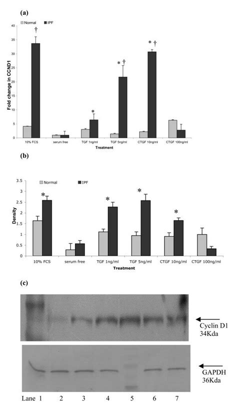 Expression Of Cyclin D Mrna And Protein In Human Lung Fibroblasts