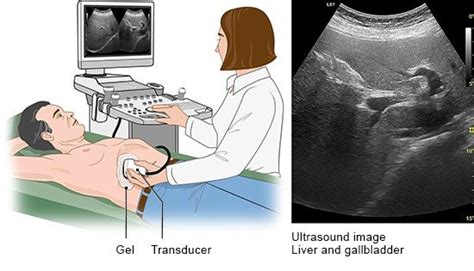 How Do Ultrasound Examinations Work