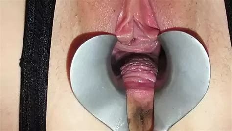 Speculum Open Vagina Stretched Gaping Gaping Porn Xhamster