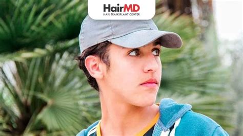 Do Hats Cause Hair Loss? Debunking the Myths | HairMD, Pune