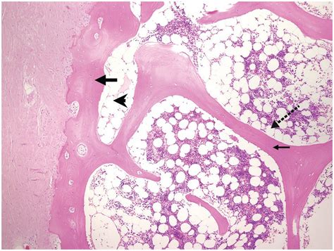 bone marrow histology